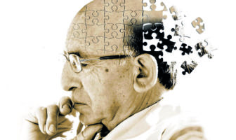 alzheimer
