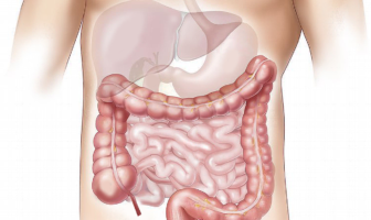 intestino
