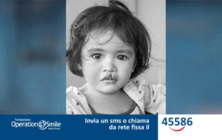 Operation Smile: a Roma weekend di visite gratuite per i bambini con malformazioni al volto smile