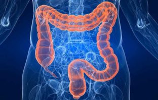 Biopsia liquida e tumore colon retto colon retto