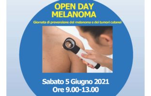 melanoma