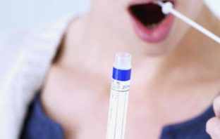 Al via l’analisi molecolare basata su test salivari saliva