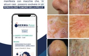 Al via la campagna “Derma point, facciamo il punto sulla cheratosi attinica” cheratosi attinica