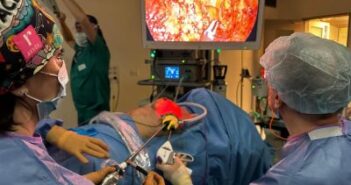 IRE: prima mastectomia con tecnica endoscopica in struttura pubblica Lazio